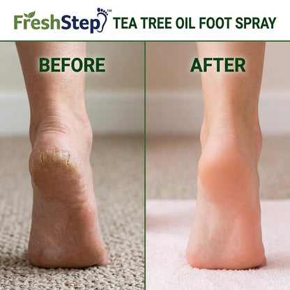FreshStep™ Tea Tree Oil Foot Spray